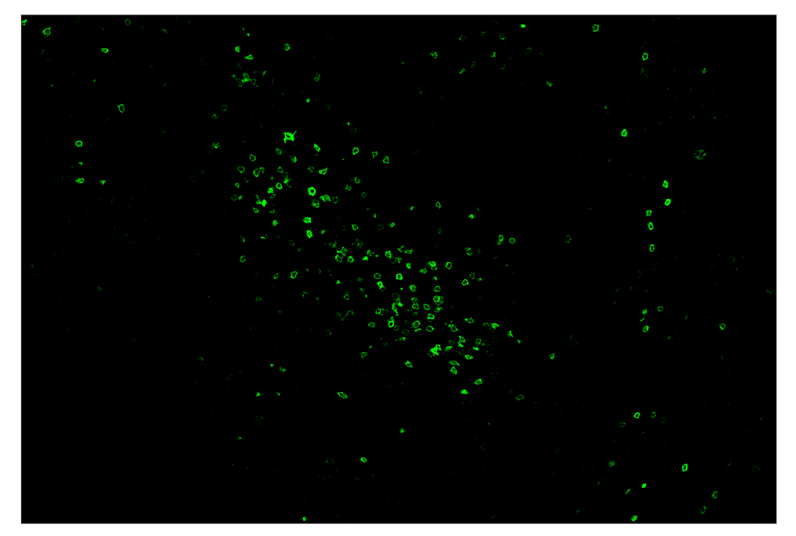 Immunohistochemistry Image 2: IL-2Rα/CD25 (E9W2J) & CO-0074-488 SignalStar<sup>™</sup> Oligo-Antibody Pair