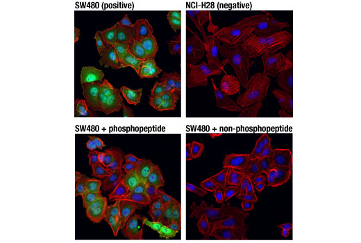 Immunofluorescence Image 1: Non-phospho (Active) β-Catenin (Ser45) (D2U8Y) XP<sup>®</sup> Rabbit mAb (BSA and Azide Free)