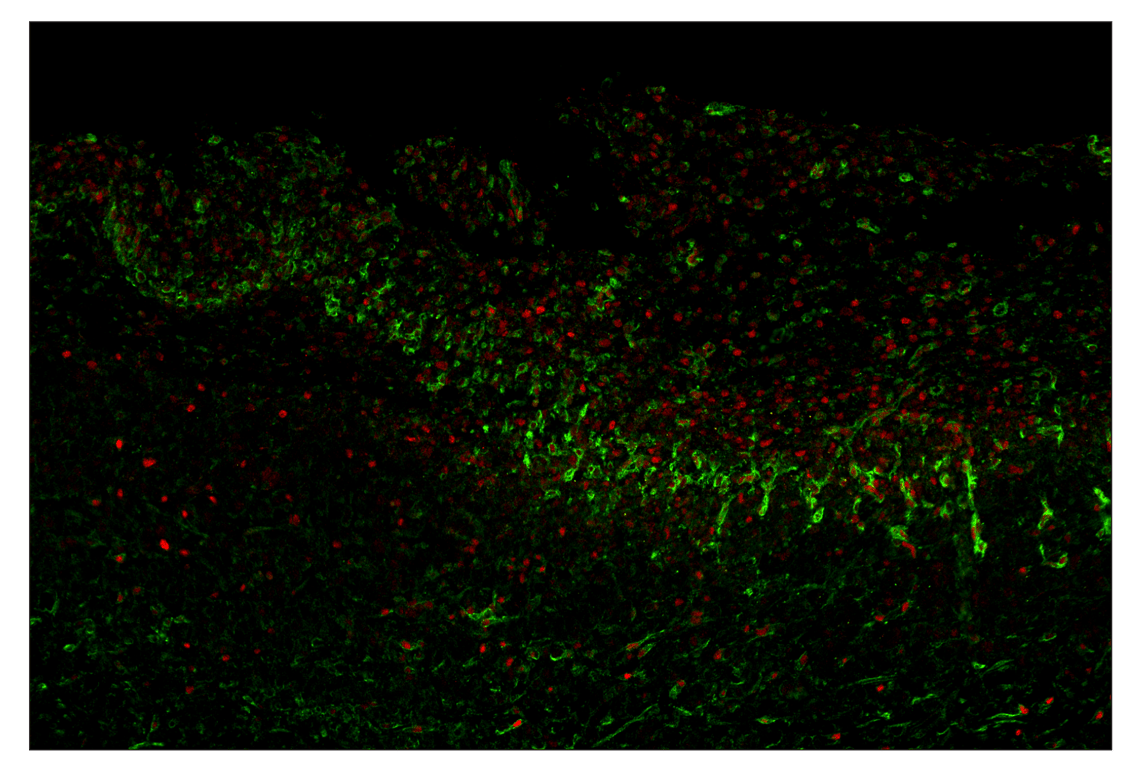 Immunohistochemistry Image 8: NT5E/CD73 (D7F9A) & CO-0039-750 SignalStar<sup>™</sup> Oligo-Antibody Pair