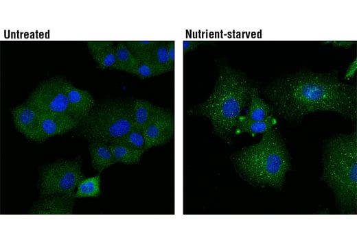 undefined Image 8: PhosphoPlus<sup>®</sup> Atg13 (Ser355) Antibody Duet