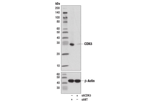 Western Blotting Image 1: CDK5 (D1F7M) Rabbit mAb