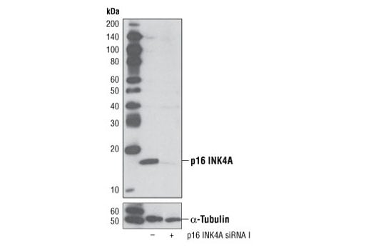 undefined Image 1: SignalSilence<sup>®</sup> p16 INK4A siRNA I