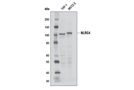 undefined Image 1: Human Reactive Inflammasome Antibody Sampler Kit II