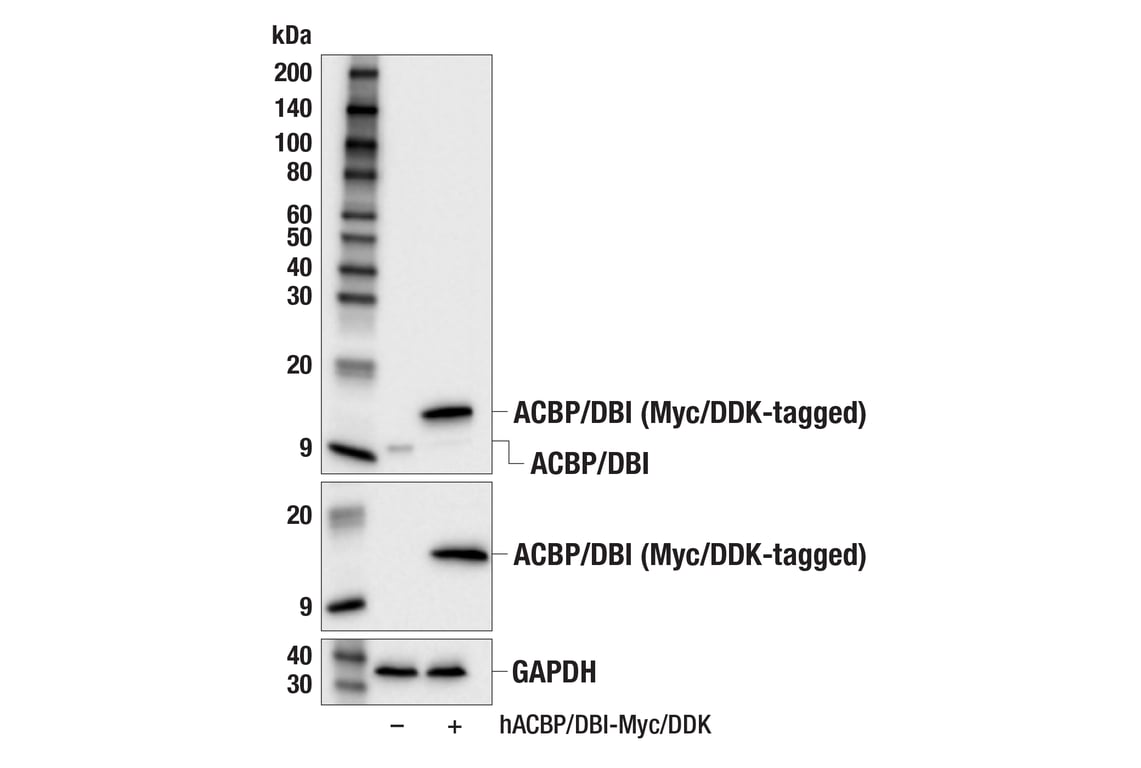 Western Blotting Image 2: ACBP/DBI (E6K8G) XP<sup>®</sup> Rabbit mAb