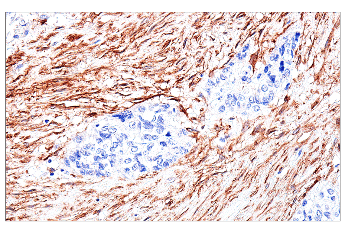 Immunohistochemistry Image 9: FAP (F1A4G) Rabbit mAb (BSA and Azide Free)