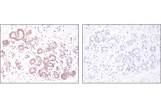 Immunohistochemistry Image 1: Argonaute 1 (D84G10) XP<sup>®</sup> Rabbit mAb