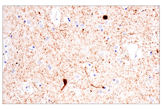 Immunohistochemistry Image 6: Calretinin (CAL6) Mouse mAb