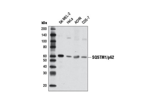 undefined Image 32: Mitophagy Antibody Sampler Kit