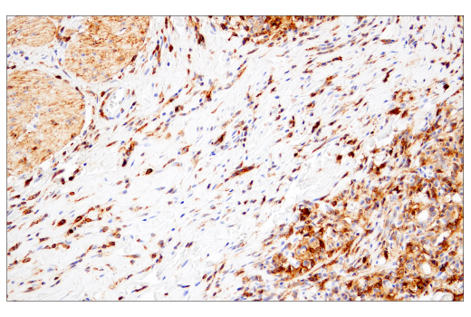 Immunohistochemistry Image 6: CD38 (E7Z8C) XP<sup>®</sup> Rabbit mAb (BSA and Azide Free)