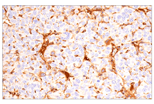 undefined Image 28: Late-Onset Alzheimer's Disease Risk Gene (Mouse Model) Antibody Sampler Kit