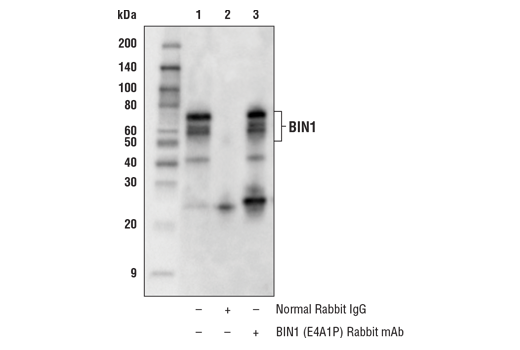 undefined Image 22: Late-Onset Alzheimer's Disease Risk Gene Antibody Sampler Kit