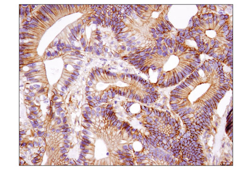 Immunohistochemistry Image 3: IQGAP1 (D8K4X) XP<sup>®</sup> Rabbit mAb