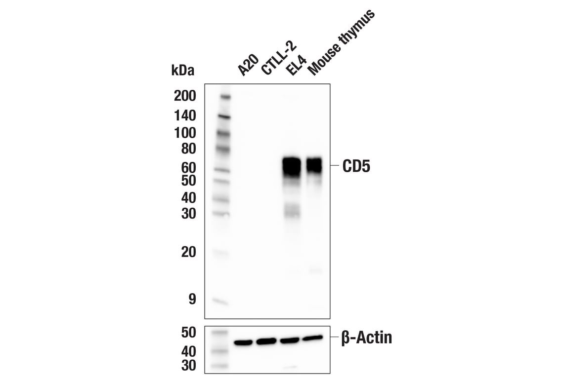 Western Blotting Image 1: CD5 (E6N9S) Rabbit mAb