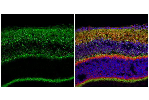 Immunofluorescence Image 1: MCU (D2Z3B) Rabbit mAb (BSA and Azide Free)