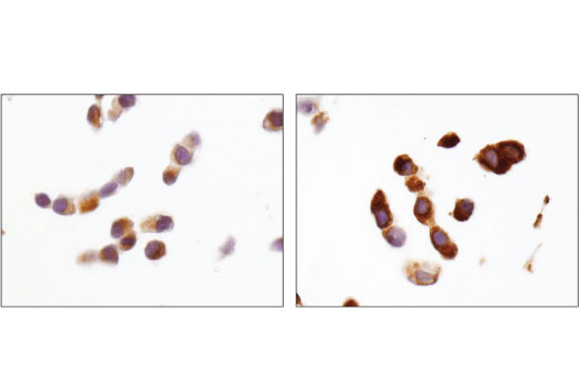 Immunohistochemistry Image 3: BNIP3 (D7U1T) Rabbit mAb
