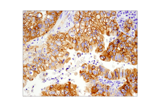 Immunohistochemistry Image 2: Met (D1C2) XP<sup>®</sup> Rabbit mAb (BSA and Azide Free)