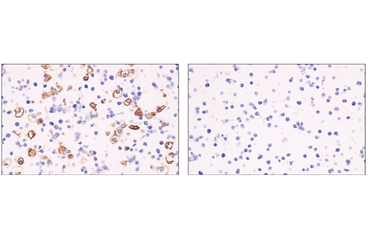 Immunohistochemistry Image 5: CD141/Thrombomodulin (E7Y9P) XP<sup>®</sup> Rabbit mAb
