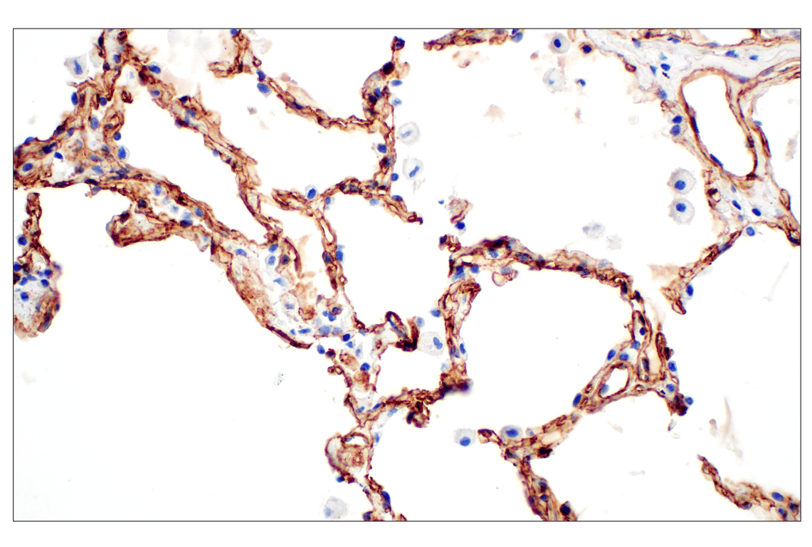 Immunohistochemistry Image 5: COL4A1 (E5M6R) Rabbit mAb (BSA and Azide Free)