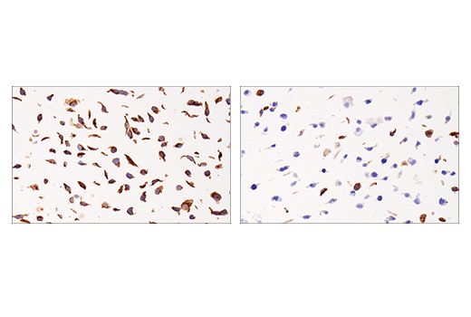 Immunohistochemistry Image 3: APP (E8B3O) XP<sup>®</sup> Rabbit mAb