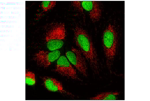 Immunofluorescence Image 1: Ubiquityl-Histone H2B (Lys120) (D11) XP<sup>®</sup> Rabbit mAb