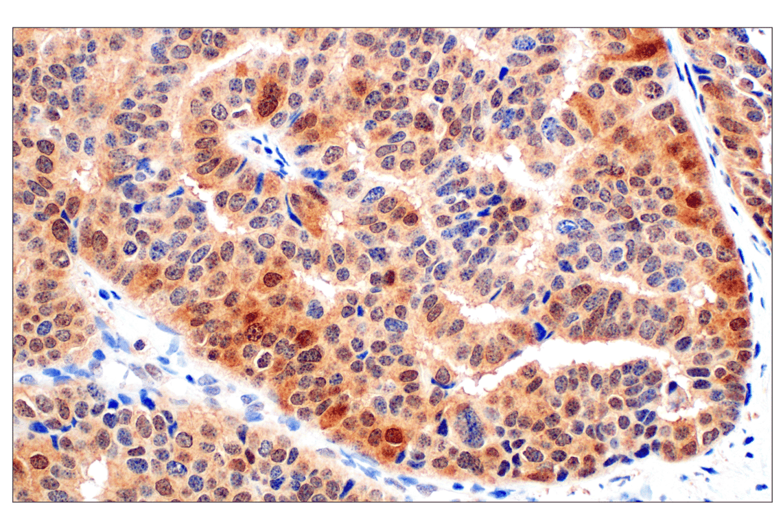 Immunohistochemistry Image 4: Stat3 (124H6) Mouse mAb