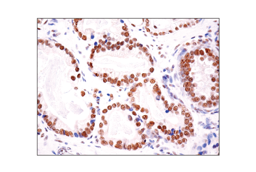 Immunohistochemistry Image 6: HAUSP (D17C6) XP<sup>®</sup> Rabbit mAb