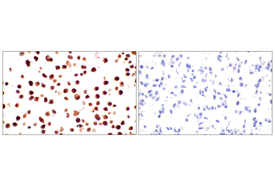Immunohistochemistry Image 11: SerpinB1 (E4W7B) Rabbit mAb