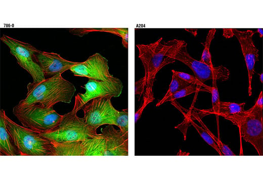 Immunofluorescence Image 1: NDRG1 (D8G9) XP<sup>®</sup> Rabbit mAb