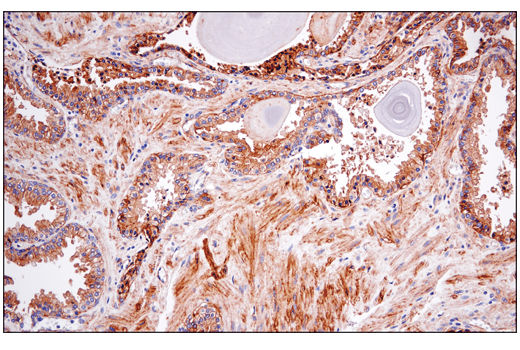 Immunohistochemistry Image 3: CD151 (E4I9J) XP<sup>®</sup> Rabbit mAb