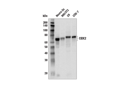 Western Blotting Image 2: CBX2 (E3N6A) Rabbit mAb