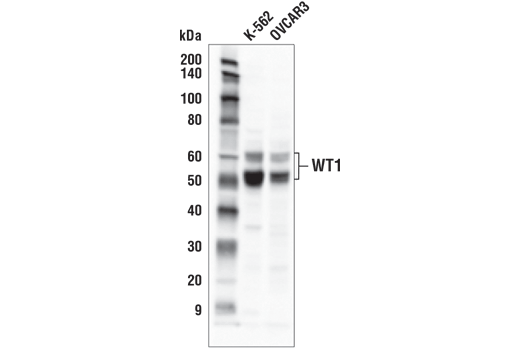 Western Blotting Image 1: WT1 (D8I7F) XP<sup>®</sup> Rabbit mAb