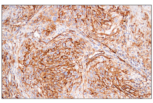 Immunohistochemistry Image 2: CD141/Thrombomodulin (E7Y9P) XP<sup>®</sup> Rabbit mAb