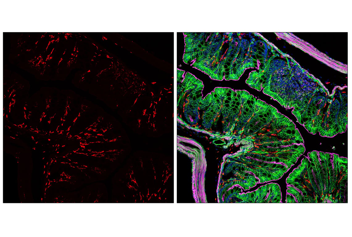 Immunofluorescence Image 1: CD206/MRC1 (E6T5J) XP<sup>®</sup> Rabbit mAb (Alexa Fluor<sup>®</sup> 647 Conjugate)