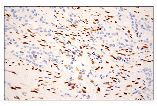 Immunohistochemistry Image 1: ZEB1 (E2G6Y) XP<sup>®</sup> Rabbit mAb (BSA and Azide Free)