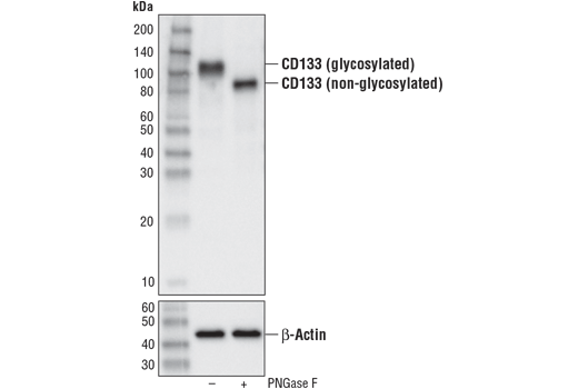 Western Blotting Image 2: CD133 (A3G6K) Rabbit mAb
