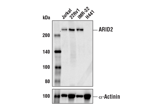 Western Blotting Image 1: ARID2 (D8D8U) Rabbit mAb