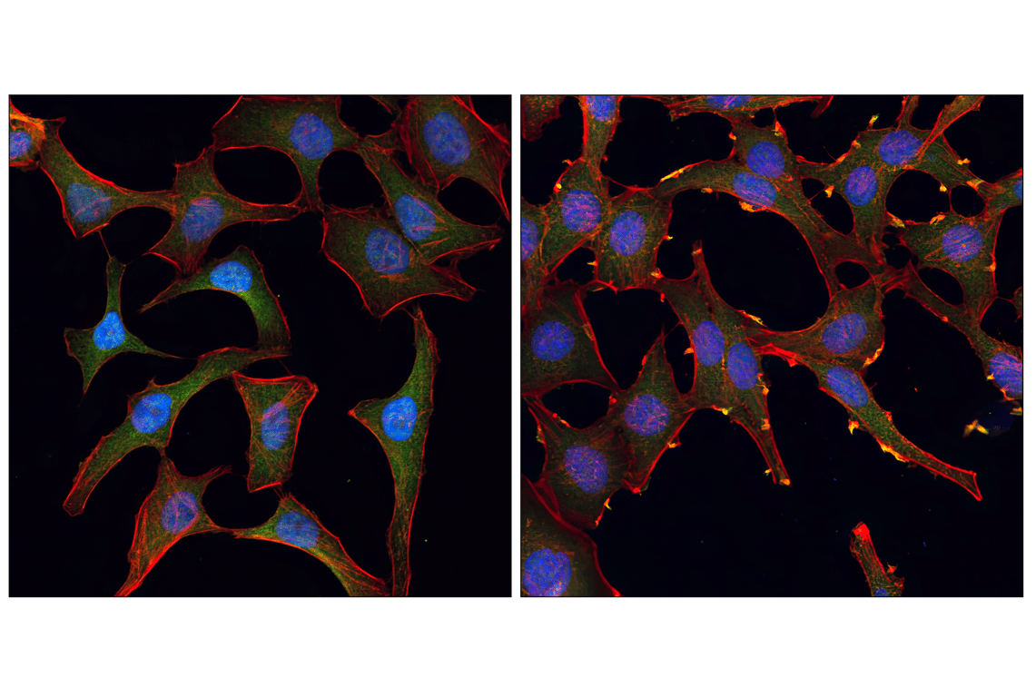 Immunofluorescence Image 1: Akt (pan) (11E7) Rabbit mAb