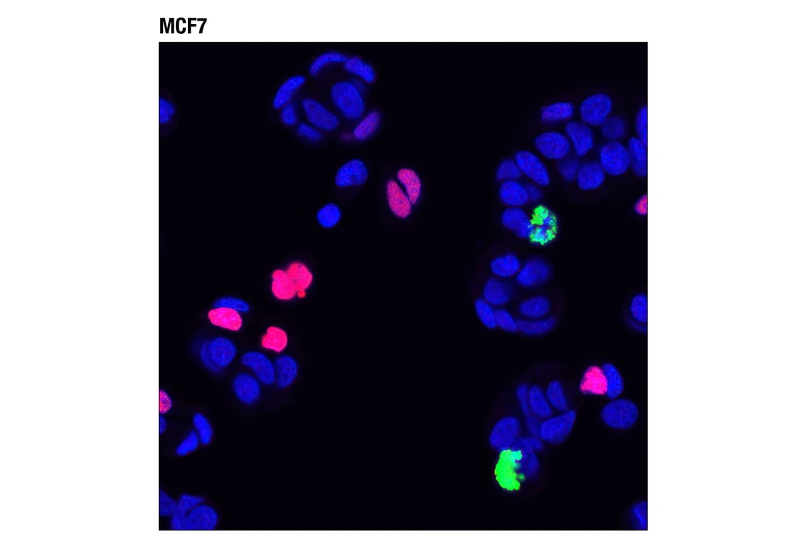 Immunofluorescence Image 1: p21 Waf1/Cip1 (12D1) Rabbit mAb (Alexa Fluor® 555 Conjugate)