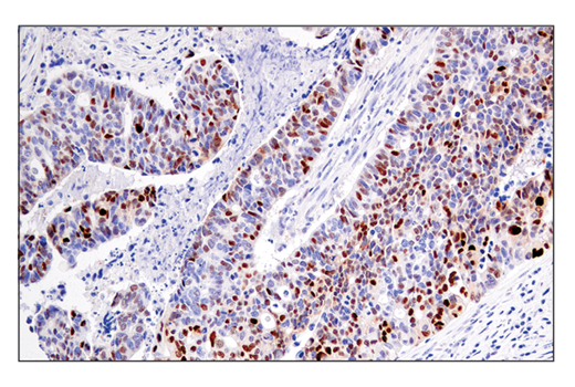 Immunohistochemistry Image 3: Cyclin D1 (E3P5S) XP<sup>®</sup> Rabbit mAb