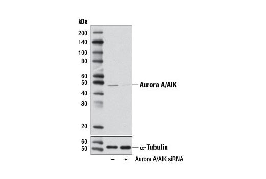 undefined Image 1: SignalSilence<sup>®</sup> Aurora A/AIK siRNA I