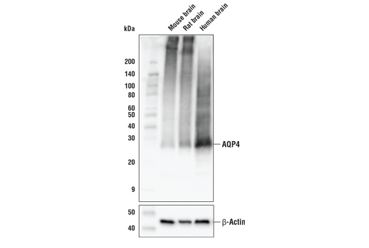 Western Blotting Image 1: AQP4 (D1F8E) XP<sup>®</sup> Rabbit mAb