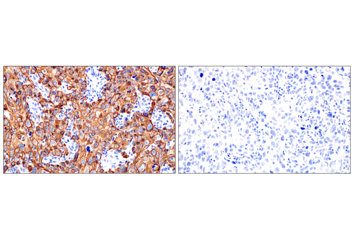Immunohistochemistry Image 9: Keratin 14 (E7W6V) Rabbit mAb