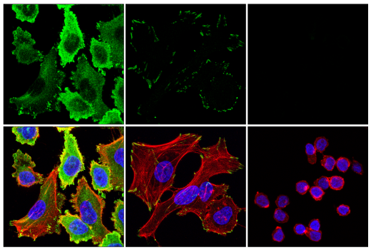 Immunofluorescence Image 1: Paxillin (E6R6Z) Rabbit mAb (BSA and Azide Free)