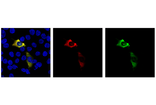 Immunofluorescence Image 1: Cas9 <i>(S. aureus) </i>(6H4) Mouse mAb (Alexa Fluor<sup>®</sup> 647 Conjugate)