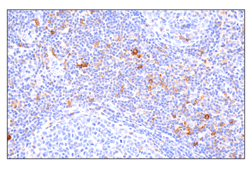 Immunohistochemistry Image 6: Phospho-SLP-76 (Ser376) (E3G9U) XP<sup>®</sup> Rabbit mAb