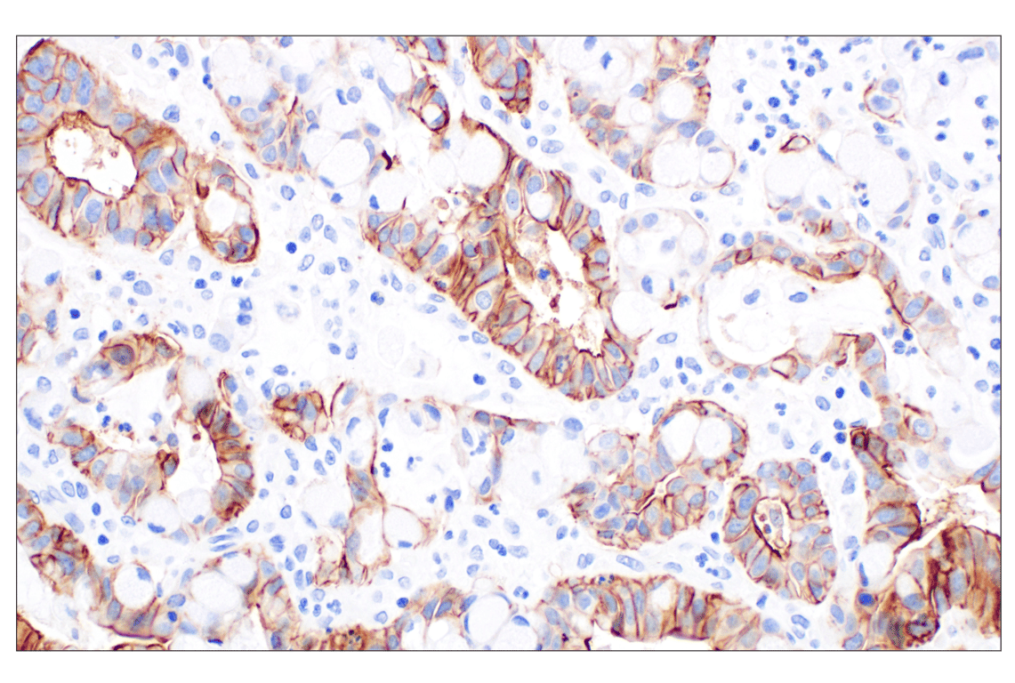 Immunohistochemistry Image 5: CD44 v5 (C44Mab-3) Mouse mAb