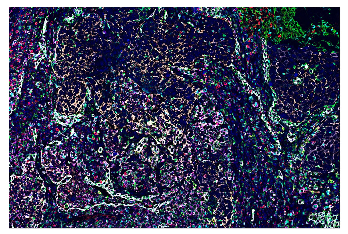 Immunohistochemistry Image 7: HLA-DRA (E9R2Q) & CO-0023-488 SignalStar<sup>™</sup> Oligo-Antibody Pair