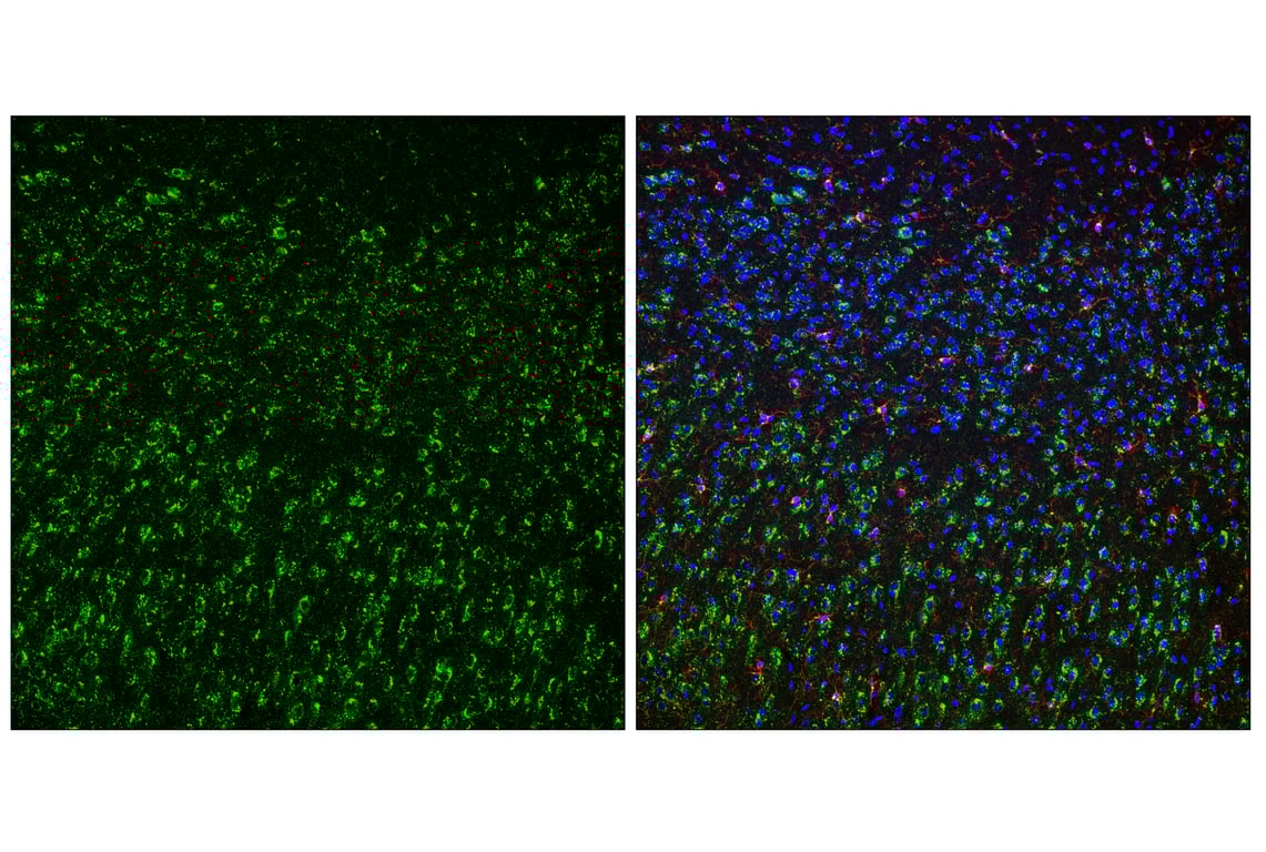 Immunofluorescence Image 2: Cathepsin D (E5V4H) Rabbit mAb