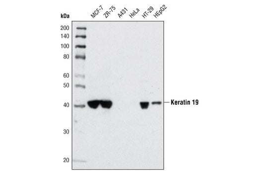 Western Blotting Image 1: Keratin 19 (BA17) Mouse mAb