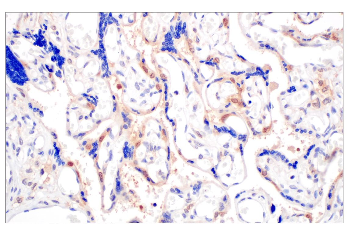 Immunohistochemistry Image 9: Galectin-8/LGALS8 (F9O3T) Rabbit mAb